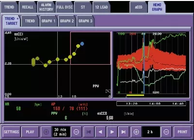 Life Scope VS BSM-3000 image 02