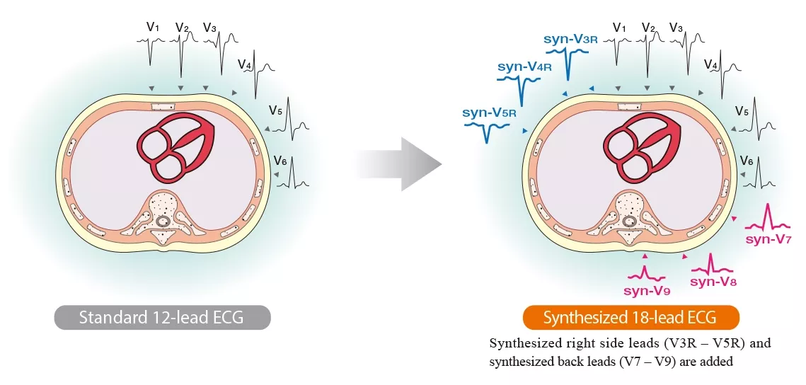 image tech syneci 01