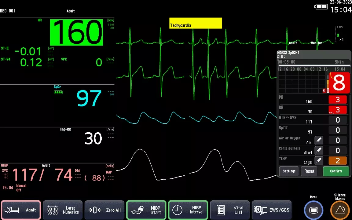 Solution Safer monitoring image 05