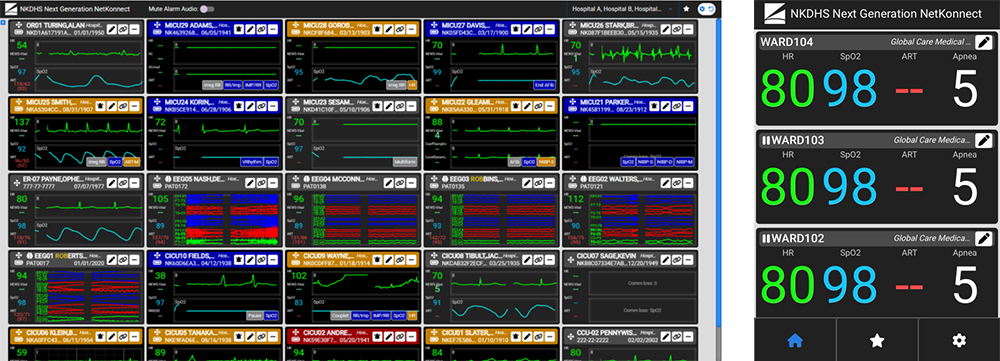 Real-time multi-bed monitoring screen displaying multiple patient vital signs simultaneously in a centralized view.Mobile interface displaying key patient vital signs from the central monitoring system, optimized for quick remote access.